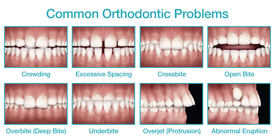common ortho problems